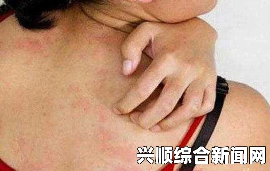 判断女性艾滋病最简单方法