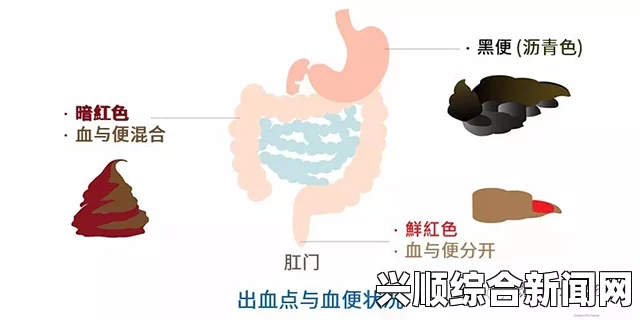 大便带血是一种常见的症状，可能由多种原因引起。在探讨这个问题之前，我们首先需要了解大便的组成和正常状态，以便更好地理解带血的原因。