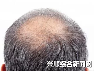 肾虚型脱发，中医视角下的脱发问题及其治疗