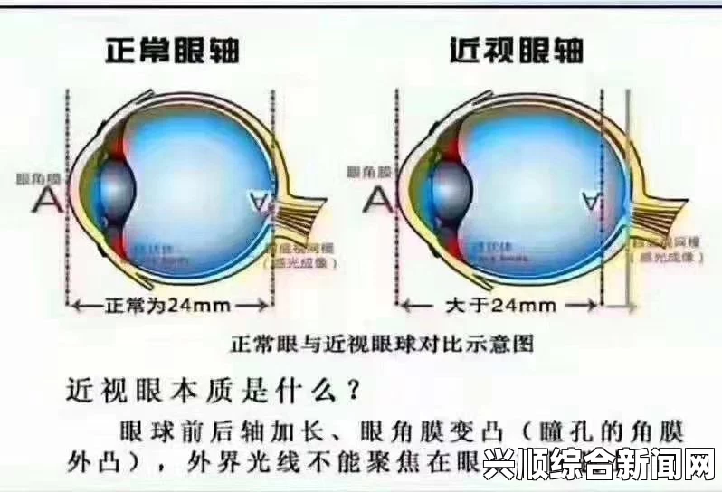 激光近视手术是一种通过激光技术来矫正视力问题的手术，其价格因地区、医院、设备、手术方式等因素而异。以下将详细介绍激光近视手术的价格及相关问题解答。