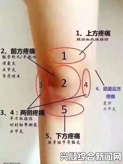 关节疼痛的主要原因