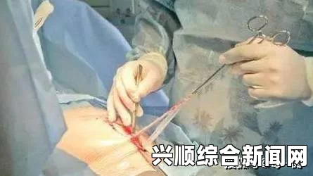 剖腹产多久可以生二胎