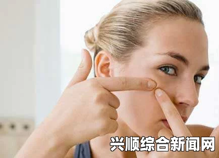 青春痘快速消除小妙招