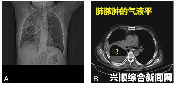 成免费CRM特点分析：全面管理客户数据与提高销售效率的创新工具，助力企业数字化转型与市场竞争力提升