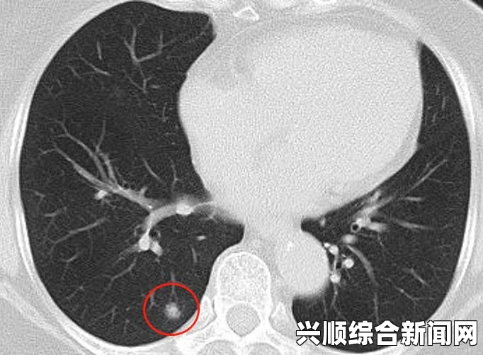 如何选择一款合适的防走失手环？从实用性和安全性出发，你应该关注哪些要点？——全面解析选购技巧与注意事项