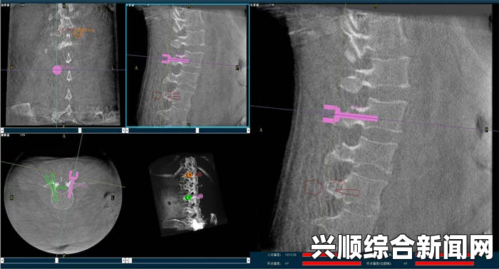 大片免费播放C1V1骨科治疗的优势