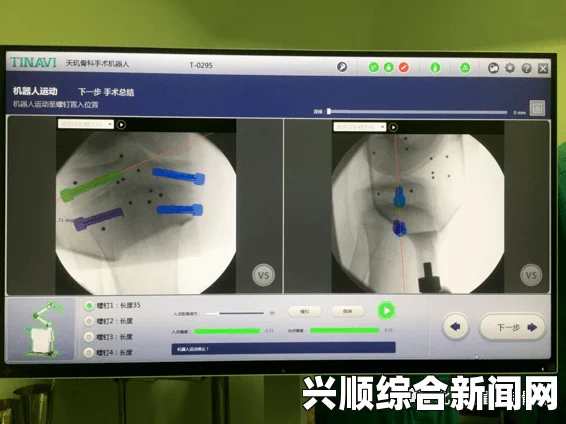 大片免费播放C1V1骨科治疗的优势