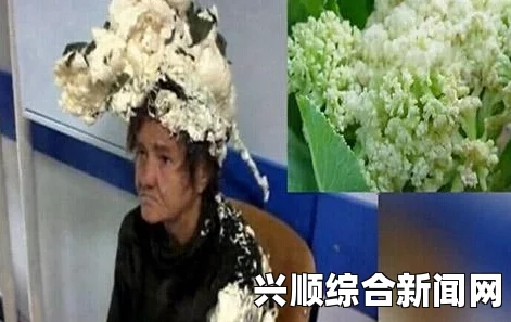 女子误将工业发泡剂当摩丝 头顶“菜花”就医(图)