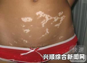 男性如何正常产生白色分泌物？了解产生原因和健康影响，探讨生理机制与注意事项