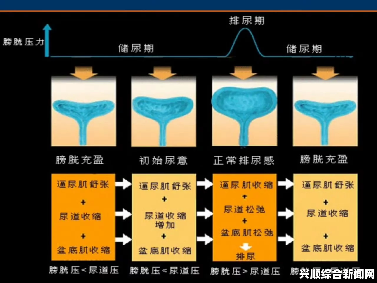 女性在达到性高潮时有想尿床的症状吗？答案解析与科学解读：探讨生理反应与心理因素的关系_制片会计审计