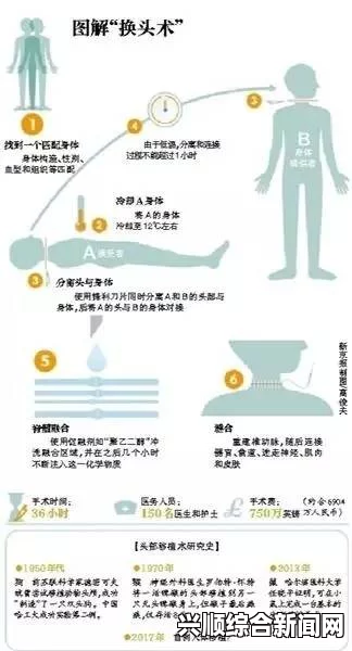 中国医生将参与实施人类首例换头术 时间定为2017年