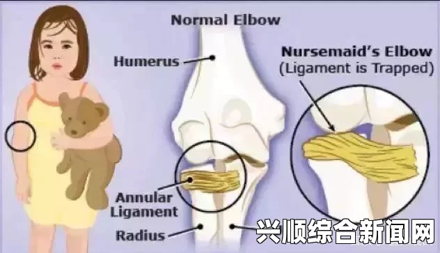 四叔教你1V2骨科：如何有效应对复杂骨折与关节错位，提升治疗成功率——掌握关键技巧与实用案例分享_免费和便捷体验如何