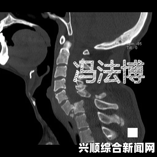 四叔教你1V2骨科：如何有效应对复杂骨折与关节错位，提升治疗成功率——掌握关键技巧与实用案例分享_免费和便捷体验如何