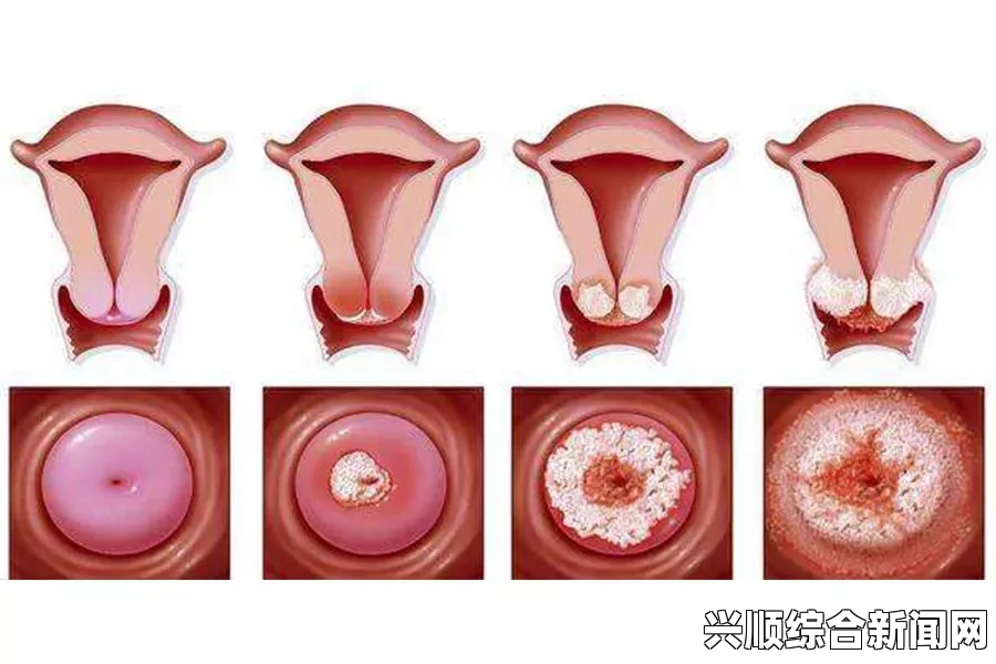 男生生殖器肿胀的原因是什么？常见病因及解决办法——深入解析与应对策略_文化与实用价值